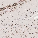 MSK1 Antibody in Immunohistochemistry (Paraffin) (IHC (P))