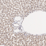 MSK1 Antibody in Immunohistochemistry (Paraffin) (IHC (P))