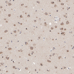MSK1 Antibody in Immunohistochemistry (Paraffin) (IHC (P))