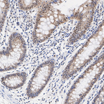 MSK1 Antibody in Immunohistochemistry (Paraffin) (IHC (P))