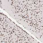 MSK1 Antibody in Immunohistochemistry (Paraffin) (IHC (P))
