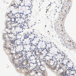 MSK1 Antibody in Immunohistochemistry (Paraffin) (IHC (P))