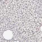MSK1 Antibody in Immunohistochemistry (Paraffin) (IHC (P))