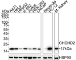 CHCHD2 Antibody in Western Blot (WB)