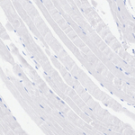 TCF7 Recombinant Rabbit Monoclonal Antibody (PSH13-89)
