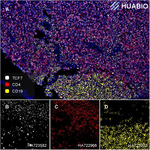 TCF7 Antibody in Multiplex Immunohistochemistry (mIHC)