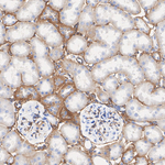 CD49a Antibody in Immunohistochemistry (Paraffin) (IHC (P))