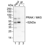 PRAK Antibody in Immunoprecipitation (IP)