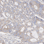 NDUFA9 Recombinant Rabbit Monoclonal Antibody (PSH14-07)