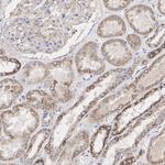 NDUFA9 Antibody in Immunohistochemistry (Paraffin) (IHC (P))