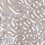 NDUFA9 Antibody in Immunohistochemistry (Paraffin) (IHC (P))