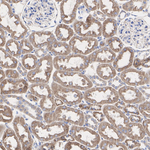 NDUFA9 Antibody in Immunohistochemistry (Paraffin) (IHC (P))