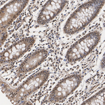 PSMA7 Antibody in Immunohistochemistry (Paraffin) (IHC (P))