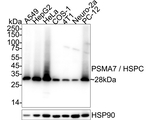 PSMA7 Antibody in Western Blot (WB)