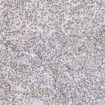 FLI1 Recombinant Rabbit Monoclonal Antibody (PSH14-17)