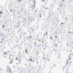 FLI1 Antibody in Immunohistochemistry (Paraffin) (IHC (P))
