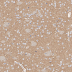 C2orf33 Antibody in Immunohistochemistry (Paraffin) (IHC (P))