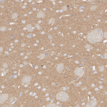 C2orf33 Antibody in Immunohistochemistry (Paraffin) (IHC (P))