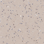 HUWE1 Antibody in Immunohistochemistry (Paraffin) (IHC (P))