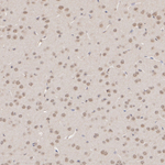 HUWE1 Recombinant Rabbit Monoclonal Antibody (PSH14-37)