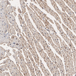 HUWE1 Antibody in Immunohistochemistry (Paraffin) (IHC (P))