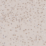 HUWE1 Antibody in Immunohistochemistry (Paraffin) (IHC (P))
