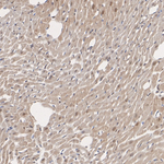 HUWE1 Antibody in Immunohistochemistry (Paraffin) (IHC (P))