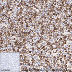 CXCL2 Antibody in Immunohistochemistry (Paraffin) (IHC (P))
