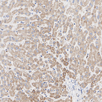 NDUFS1 Antibody in Immunohistochemistry (Paraffin) (IHC (P))