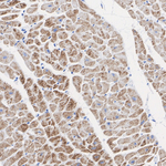 NDUFS1 Antibody in Immunohistochemistry (Paraffin) (IHC (P))