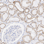 NDUFS1 Antibody in Immunohistochemistry (Paraffin) (IHC (P))