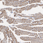 NDUFS1 Antibody in Immunohistochemistry (Paraffin) (IHC (P))