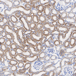 NDUFS1 Recombinant Rabbit Monoclonal Antibody (PSH14-45)