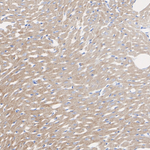 NDUFS1 Antibody in Immunohistochemistry (Paraffin) (IHC (P))