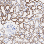 NDUFS1 Antibody in Immunohistochemistry (Paraffin) (IHC (P))