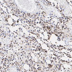 Granzyme B Antibody in Immunohistochemistry (Paraffin) (IHC (P))
