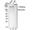 TSC1 Antibody in Immunoprecipitation (IP)