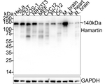 TSC1 Antibody in Western Blot (WB)