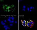BDH1 Recombinant Rabbit Monoclonal Antibody (PSH14-69)