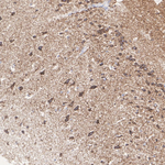 BDH1 Antibody in Immunohistochemistry (Paraffin) (IHC (P))