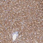 BDH1 Antibody in Immunohistochemistry (Paraffin) (IHC (P))