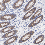 BDH1 Antibody in Immunohistochemistry (Paraffin) (IHC (P))