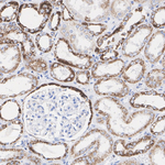 BDH1 Antibody in Immunohistochemistry (Paraffin) (IHC (P))