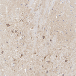 BDH1 Antibody in Immunohistochemistry (Paraffin) (IHC (P))