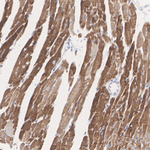 BDH1 Antibody in Immunohistochemistry (Paraffin) (IHC (P))