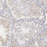 BDH1 Antibody in Immunohistochemistry (Paraffin) (IHC (P))