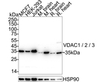 VDAC1/VDAC2/VDAC3 Recombinant Rabbit Monoclonal Antibody (PSH14-90)