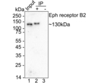 EphB2 Antibody in Immunoprecipitation (IP)