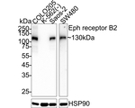 EphB2 Antibody in Western Blot (WB)