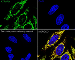 ATP Synthase O Antibody in Immunocytochemistry (ICC/IF)